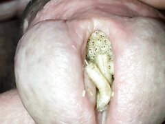 Maggots In Cock   Video 2