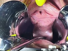 Orgasm With Speculum After Peehole And  Cervix Sounding