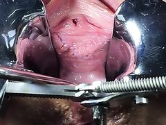 Orgasm With Speculum After Peehole And  Cervix Sounding