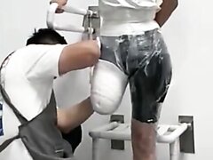 Chinese Amputee Fitting Prosthetic Leg